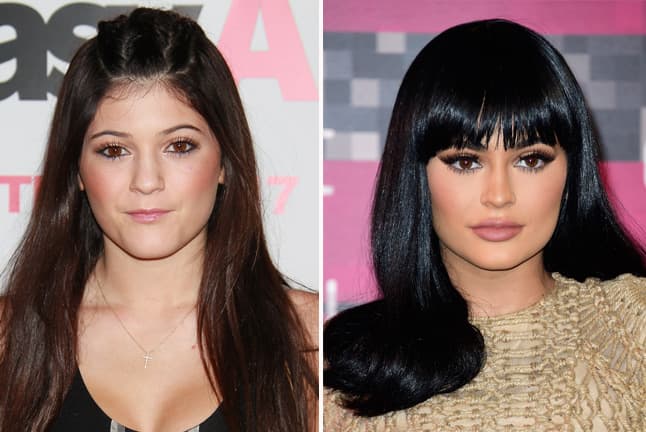 Sin embargo los cambios eran más notorios y la comparación con fotos anteriores no cedía, por lo que la famosa tuvo que aceptar que sí se había hecho unos arreglitos en esa boquita.