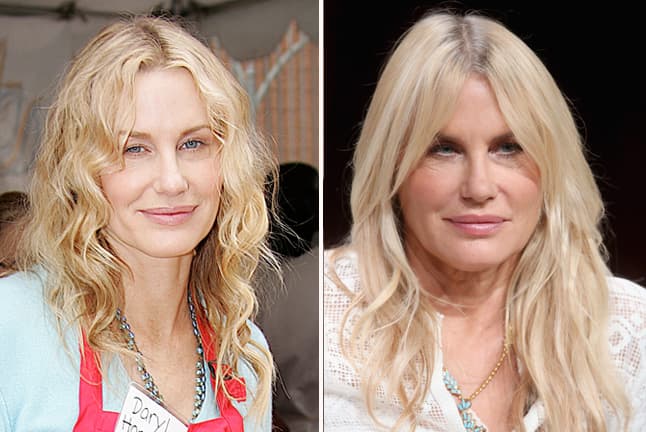 Sus labios eran delgados pero muy bien definidos, pero ahora de eso ya no queda absolutamente nada.