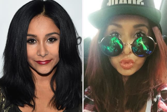Recientemente Snooki anunció en sus redes sociales que se había sometido a un aumento de labios, debido a que los quería tener igual de Kylie Jenner.