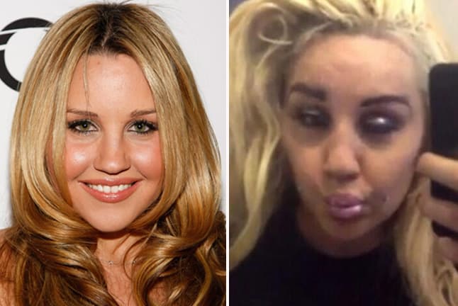 Ella fue otra de las famosas que cometió un grave error cuando decidió cambiarlos de esta brusca manera.