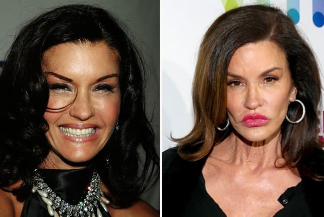 Al menos es de las pocas que no tiene problemas en admitir que se ha realizado diferentes cirugías. Una lástima que esa boquita ya no luzca tan antojable como antes.