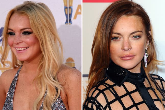 ¿Cuál era la necesidad de transformar esa linda boquita?, ¿o a ustedes les gusta con exceso de colágeno?