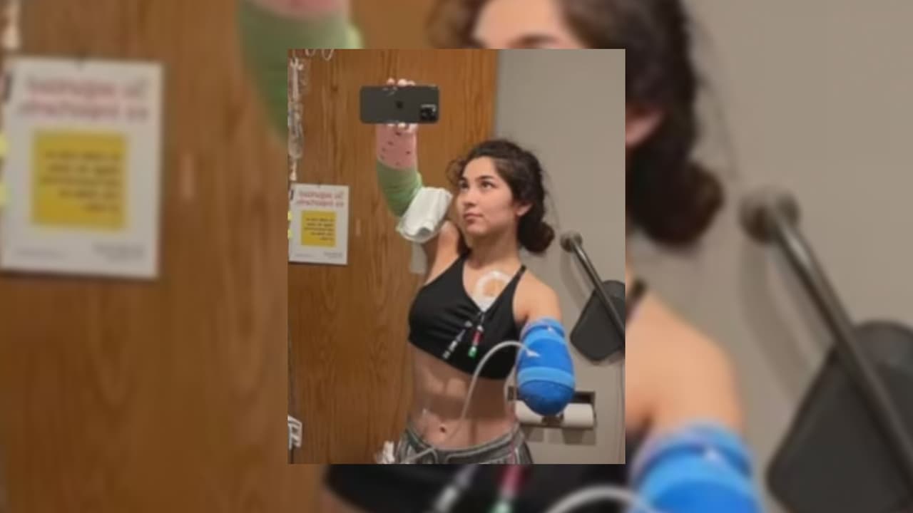 "Desafortunadamente mi brazo desarrolló una infección, por lo que no se pudo salvar".