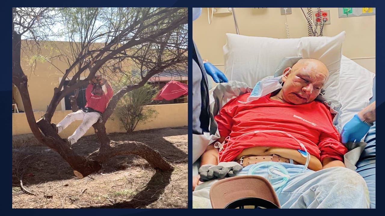  "Me empezó a patear": jardinero hispano describe cómo fue atacado por alguien molesto por el ruido de su trabajo