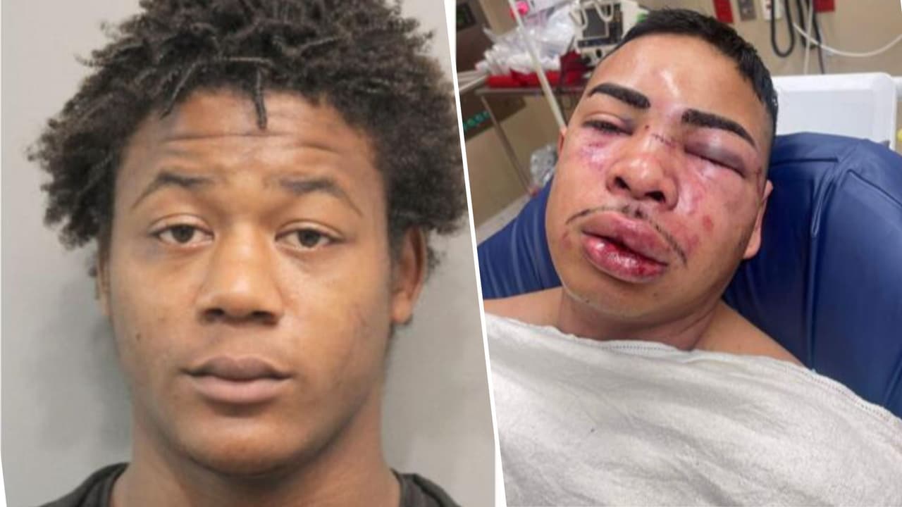 "Tiene largo historial delictivo": dicen de reo sospechoso de dar golpiza a oficial en cárcel de Texas