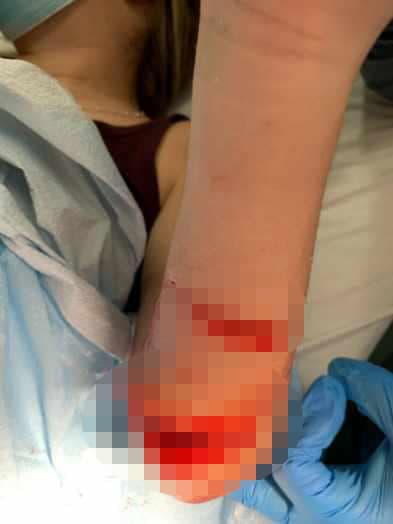 Las autoridades municipales dijeron que el ataque fue en aguas entre Cabañas Kitten y Mojacasabe.
<br>