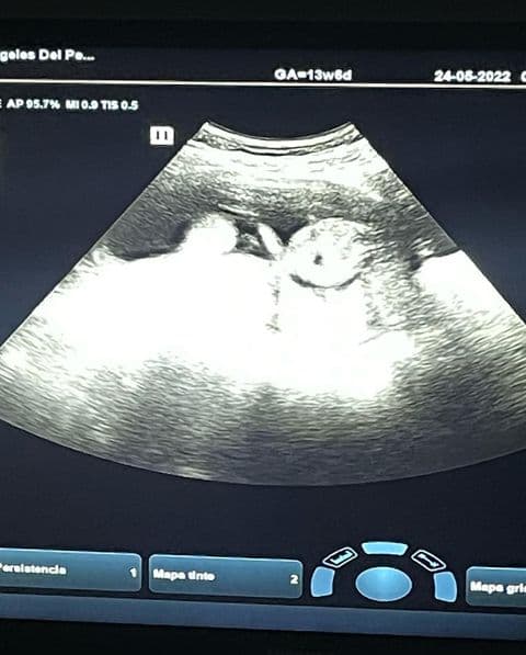 “Para mi hijo(a): Aún no sabemos si serás un niño o una niña, pero lo que puedes tener por seguro es que ya te amamos”, es parte de lo que escribió el también cantante.
<br>