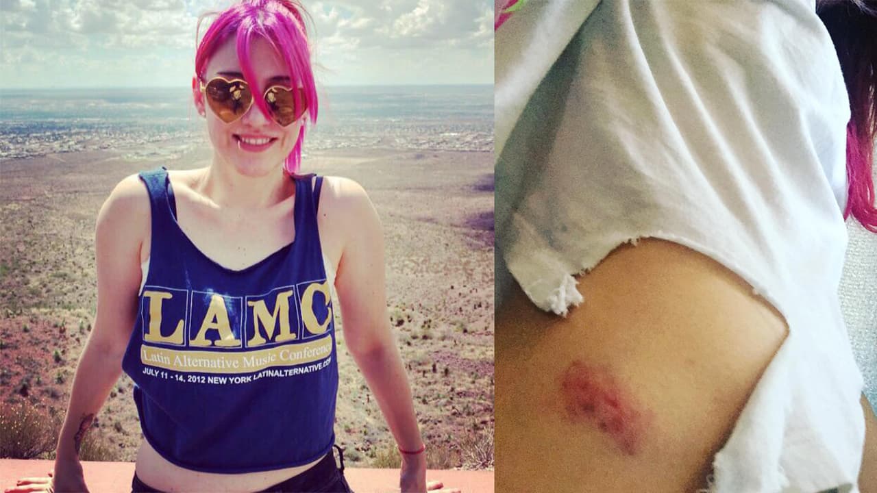 La vocalista de JotDog fue atacada a golpes por un hombre en la Ciudad de México