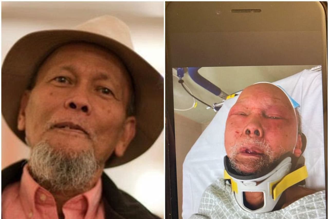 La policía de Filadelfia pidió ayuda al público para identificar a quien golpeó y ató a un hombre de 83 años dentro de su casa en Hunting Park durante un robo en Nochevieja.