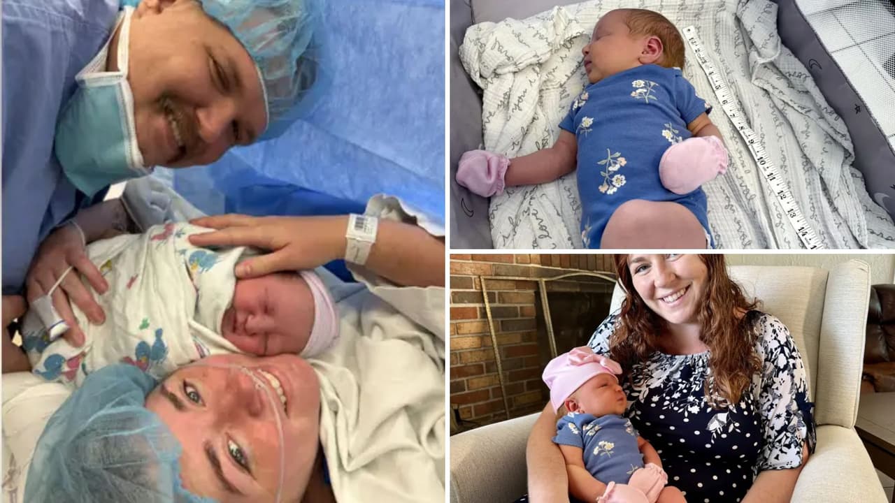 La recién nacida crece rápidamente y ya usa ropa de 3 a 6 meses por su tamaño poco común.