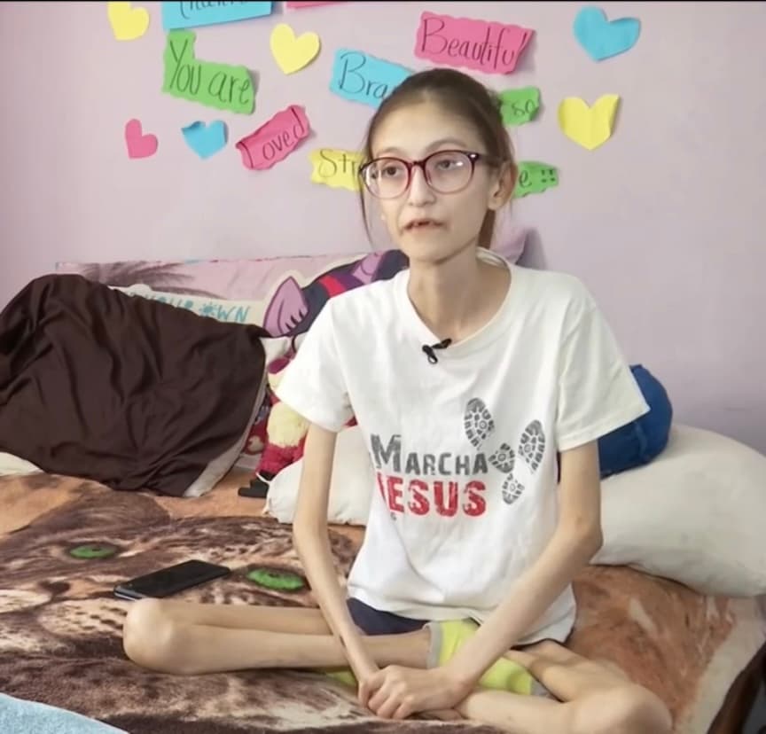 Además de esta complicación, ahora tiene que aguantar fuertes dolores que llegan a ser tan insoportables que su cuerpo se mueve de manera involuntaria, por lo que simplemente no puede vivir en paz. “Es un dolor inexplicable (…) que me quita las ganas de comer.
<b> Me da más miedo comer porque siento que después me va a doler mucho”, cuenta Ada. </b>
<br>