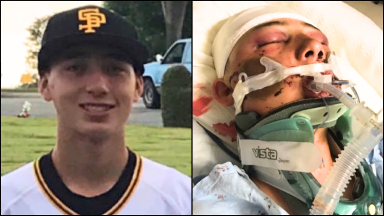 Adolescente se debate entre la vida y la muerte tras recibir golpiza de pandilleros