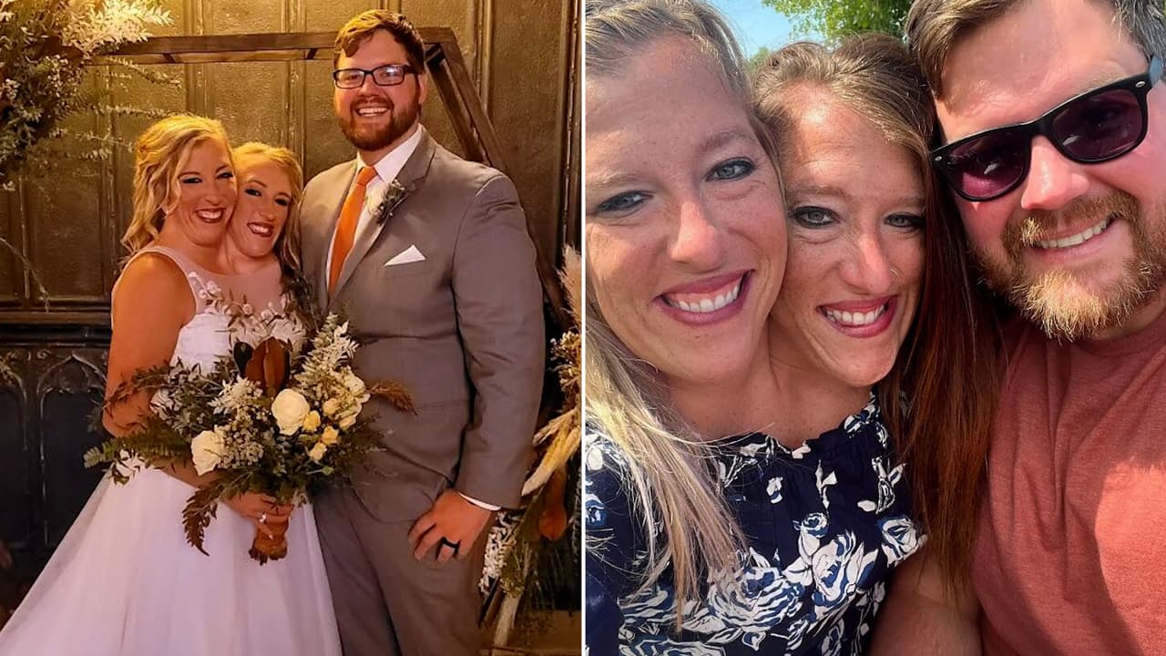 ¿Quién es el hombre con el que se casó la famosa siamesa Abby Hensel? Esta es su historia