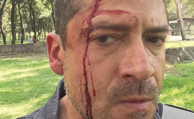 Agreden a un periodista que grababa con una cámara oculta cómo se vende droga en la universidad más grande de México