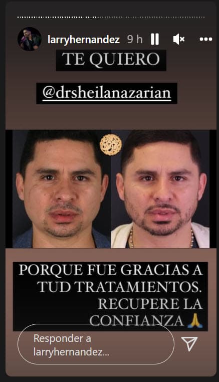 Tuvo que recurrir a un cirujano plástico para atender las varias cicatrices que le quedaron en la parte derecha de su rostro, además de que presentó dificultades para hablar. 
<br>