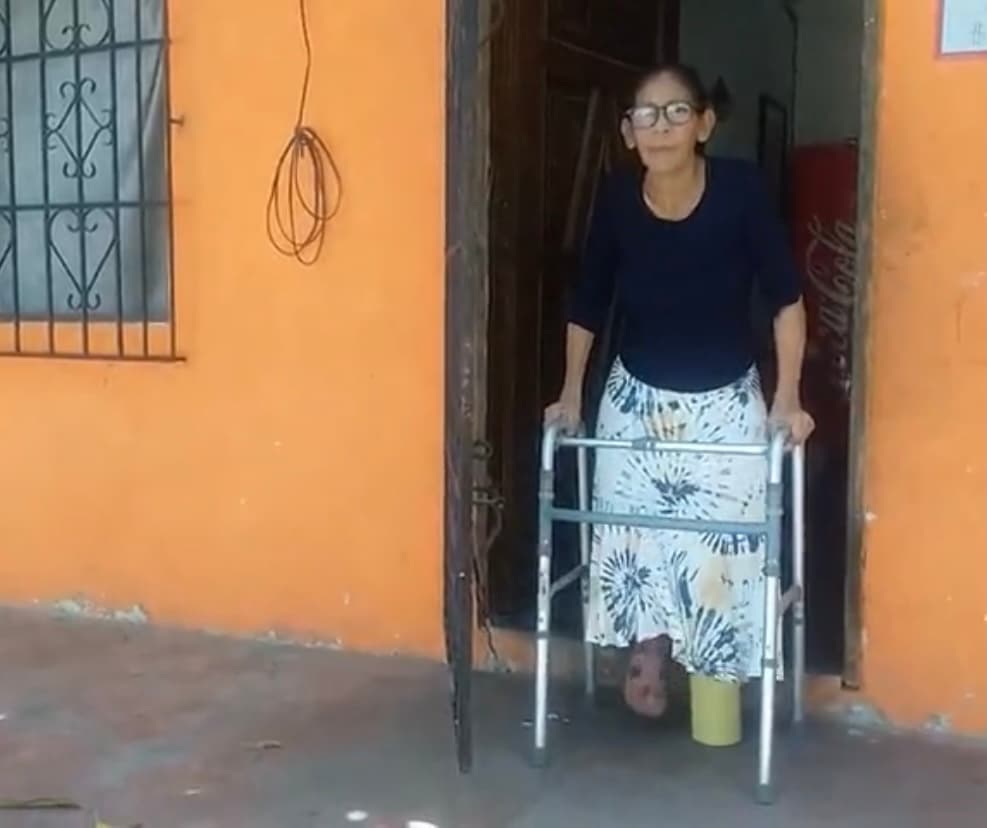 Aunque sabía que le habían quedado chicos esos zapatos que le regalaron, su 
<a href="https://www.univision.com/temas/pobreza">pobreza</a> y la necesidad de caminar para ganarse el sustento de su casa la obligaron a seguir usándolos, 
<b>sin imaginar que esa simple decisión la dejaría sin una pierna. </b>
<br>