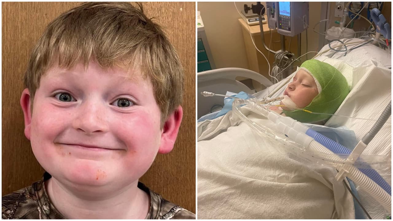 Niño de 11 años pierde parte de sus orejas y cuero cabelludo tras ser atacado por 3 pitbull en Georgia