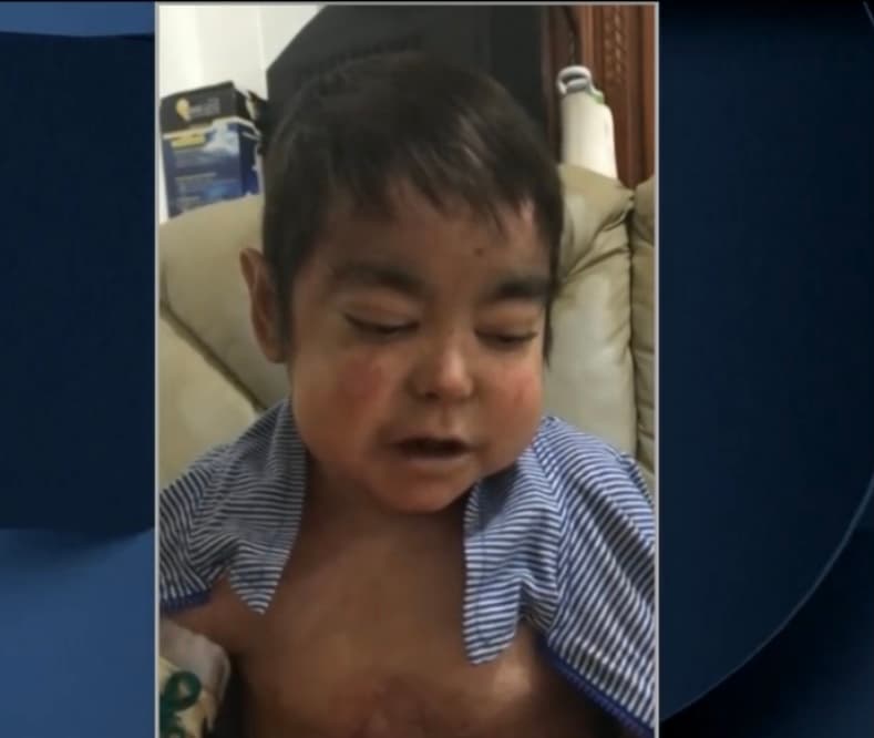 Sin dudar, Ángel asegura que está viviendo lo más difícil de su enfermedad al perder su capacidad auditiva. "Yo era feliz antes caminando, y de la noche a la mañana ya no pude hacerlo. Todo fue empeorando cada día más y más", añade. 
<br>