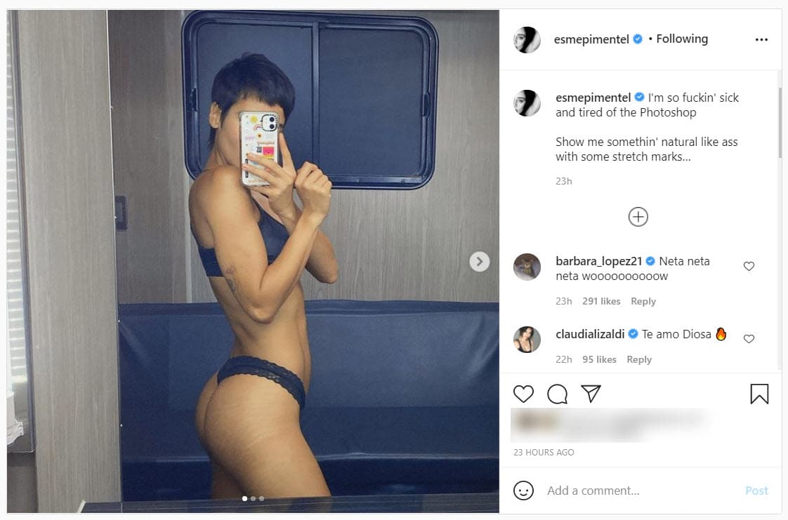 Pimentel compartió una fotografía en ropa interior donde se aprecian las estrías en sus glúteos.
<br>