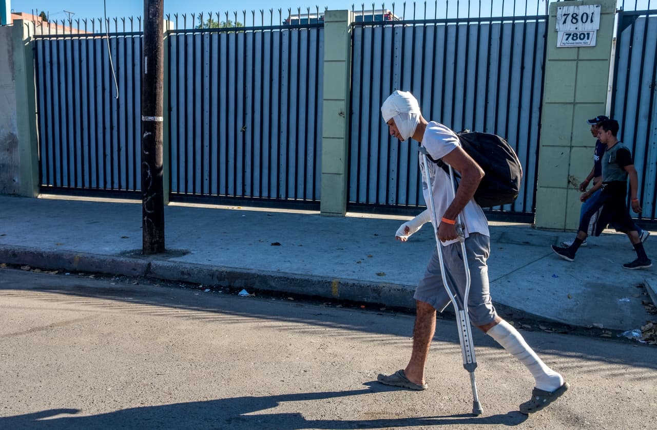 <b><a href="https://www.univision.com/noticias/frontera-eeuu-mexico/la-caravana-migrante-frente-al-muro-de-trump?123=">Volver al especial: La Caravana Migrante frente al muro de Trump</a></b>
<br>
<br>Ir a los capítulos anteriores:
<b><a href="https://www.univision.com/noticias/frontera-eeuu-mexico/1-muro-la-caravana-migrante-frente-al-muro-de-trump-fotos">MURO</a> y <a href="http://https://www.univision.com/noticias/frontera-eeuu-mexico/2-refugio-la-caravana-migrante-frente-al-muro-de-trump-fotos?123">REFUGIO</a></b>