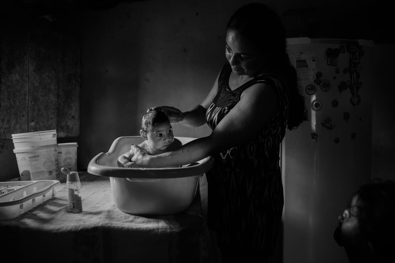 <b>Víctimas del Zika.</b> El brasileño Lalo de Almeida, del diario Folha de Sao Paulo, obtuvo el segundo premio en la categoría Contemporánea. La imagen tomada en la zona rural de Sao Vicente do Serido, Brasil, muestra a Adriana Cordeiro Soares mientras baña a su hijo de tres meses, Joao Miguel, nacido con microcefalia causada por el virus Zika.
<br>