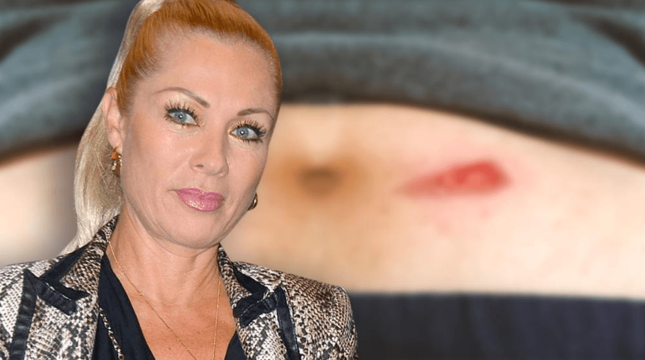 La actriz mexicana 
<b><a href="https://www.univision.com/famosos/parece-el-cuento-de-nunca-acabar-las-veces-que-yadhira-carrillo-y-lety-calderon-se-han-desmentido-en-publico-fotos">Lety Calderón sufrió un accidente</a></b> en casa y se lo contó a sus fans en las redes sociales.