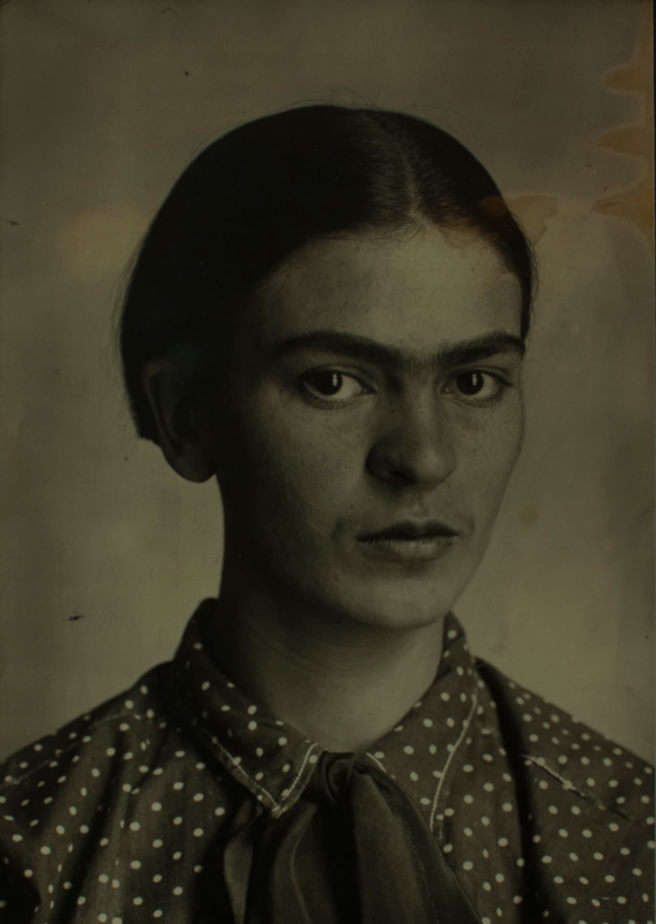 Sus profundos dolores médicamente relacionados con la fribromialgia, su compleja relación consigo misma y su imagen y la compleja relación que llevaba con el muralista mexicano hicieron que Frida Kahlo presentara serios y repetidos episodios de depresión, que sin embargo, como lo revela el libro de Salomon Grimberg, ‘Frida Kahlo: Song of Herself’ sobrellevó a través del arte.
<br>