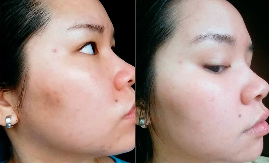 En el sitio Holy Snails muestran la piel antes y el después del suero.