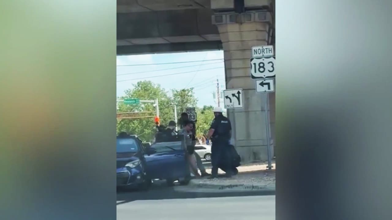 Inmigrante venezolano baleado por ICE en Austin es operado con éxito para extraerle la bala de la espalda