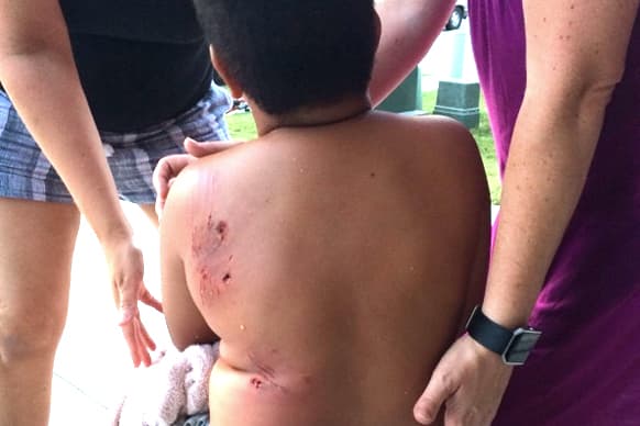 El refugio de animales de la ciudad de Houston, BARC, recomienda nunca intentar terminar una pelea de perros y mucho menos metiendo las manos sin protección. Exiten una serie de indicaciones que se deben tener en cuenta cuando un animal es agresivo.
<b><a href="https://www.houstontx.gov/barc/avoiding_dog_bites.html" target="_blank">Mira aquí la lista completa aquí. </a></b>