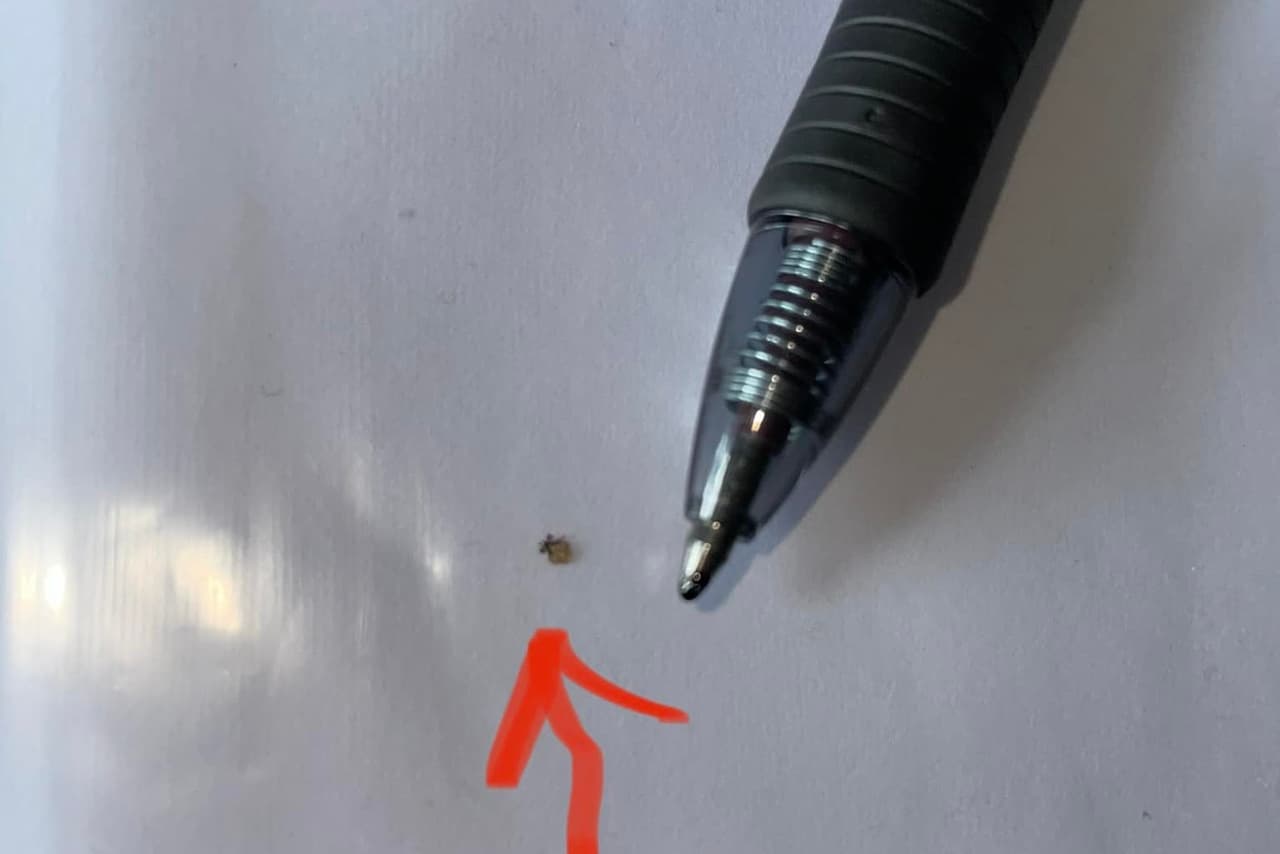 Esta es la diminuta garrapata que extrajeron de la espalda de Jonny y que le transmitió el virus potencialmente mortal.