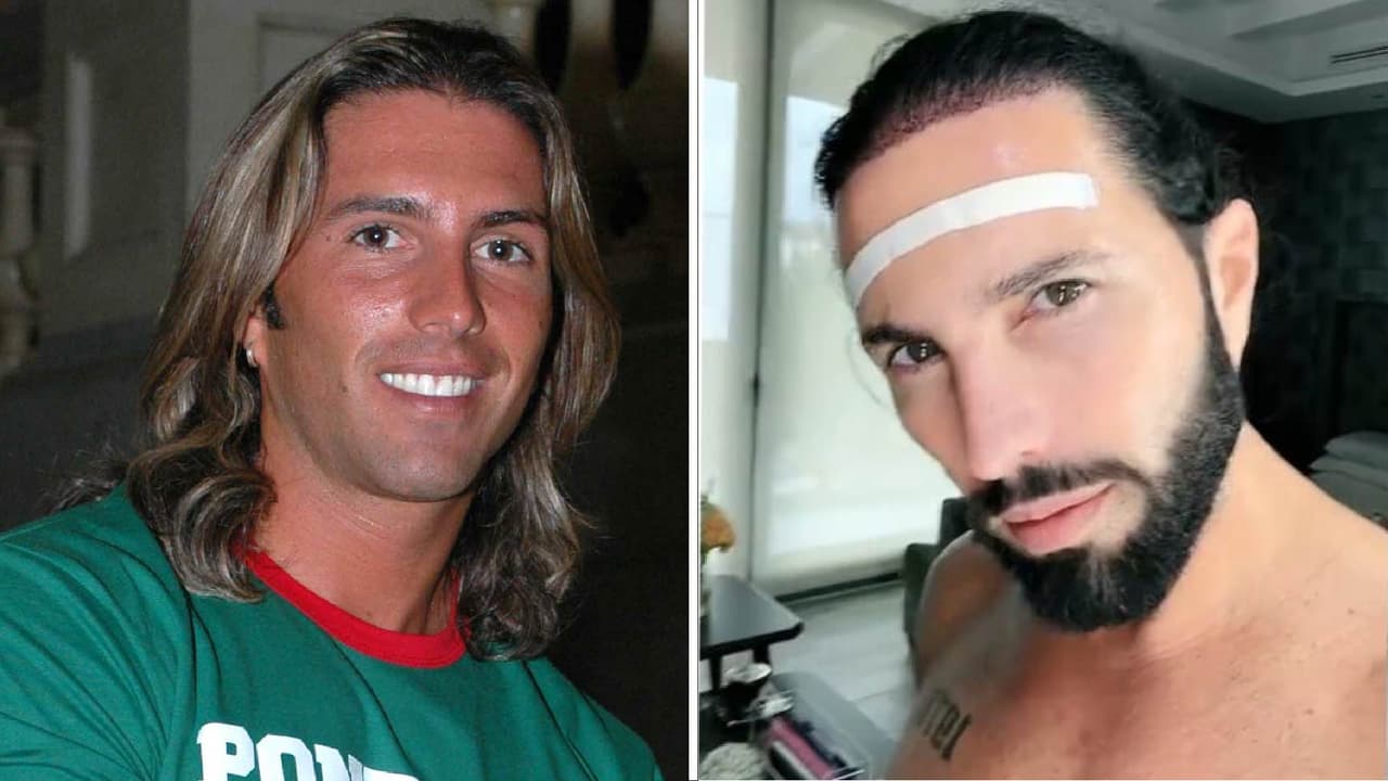 Poncho De Nigris se ha hecho varios arreglitos: el injerto de cabello es sólo uno