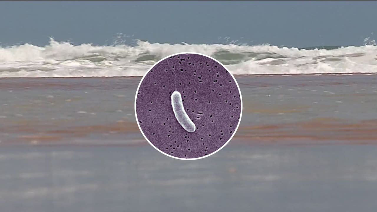 Florida registra 25 casos de bacteria come carne: estos son los lugares de mayor riesgo