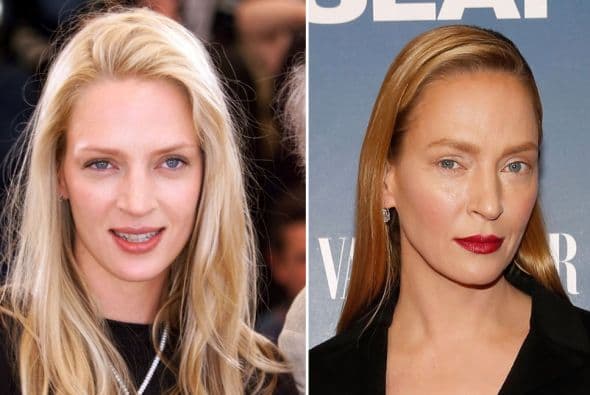 El nuevo rostro de Uma Thurman ha causado revuelo.