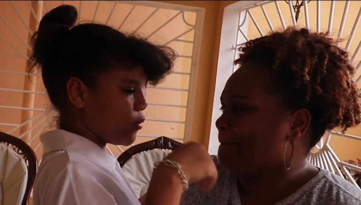 Y es que si bien Blanco recibe el amor de su madre Yahaira Pérez, la deformidad que atraviesa su rostro le ha dejado una apariencia que ha sido motivo de burlas entre la comunidad de República Dominicana en la que reside. 
<br>