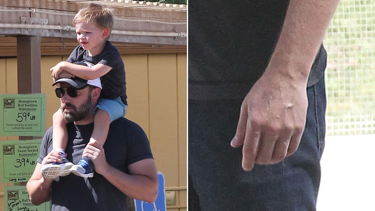 Ben Affleck ya se quitó su anillo.