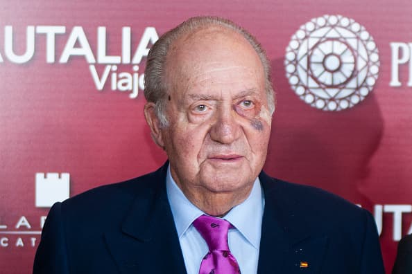 <b><a href="https://www.univision.com/noticias/los-momentos-memorables-del-rey-juan-carlos-fotos">El rey emérito Juan Carlos de España</a></b> preocupó a algunas personas cuando el pasado viernes se presentó en la plaza de toros Las Ventas, en Madrid, luciendo un moretón muy cerca de su inflamado ojo izquierdo.