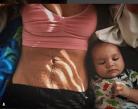 <b>"Se preguntarán por qué subo esta foto. Me llevó 18 meses llegar aquí, 18 meses mirarme en el espejo, 18 meses sentirme bella en mi piel de nuevo"</b>, 
<a href="https://www.instagram.com/p/BevVyROF_Ia/?taken-by=takebackpostpartum">escribe esta mamá.</a> "Nadie te advierte sobre las zonas oscuras de la maternidad y el embarazo, ni cuánto cambiarás física y mentalmente tras convertirte en madre".