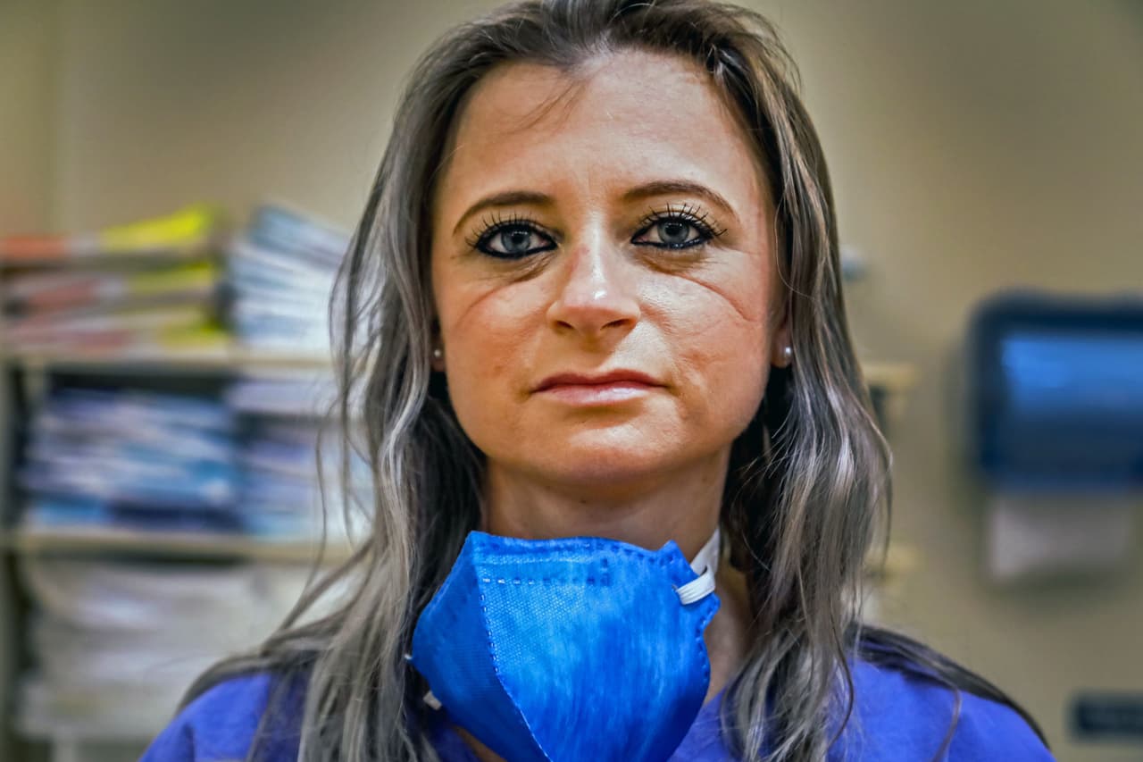 <b>Brasil: 634</b> 
<b>trabajadores de la salud muertos por covid-19. </b>Amnistía indica que la asociación de profesionales de la salud de este país ha denunciado la insuficiencia de equipos PPE, la falta de protocolos claros para el manejo de pacientes y la ausencia de apoyo en salud mental. En la fotografía Andrezza Verli, una enfermera con moretones en su rostro por el uso prolongado del equipo de protección en un hospital de Porto Alegre, a mediados de agosto.