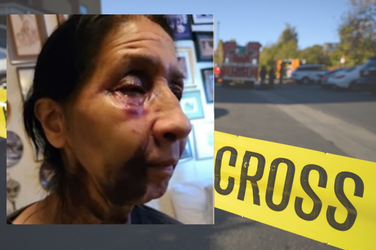 La sospechosa del ataque, Yasmine Beasley, una afroestadounidense de 23 años, fue arrestada y enfrentará cargos en relación a un crimen de odio y abuso a una persona de la tercera edad.