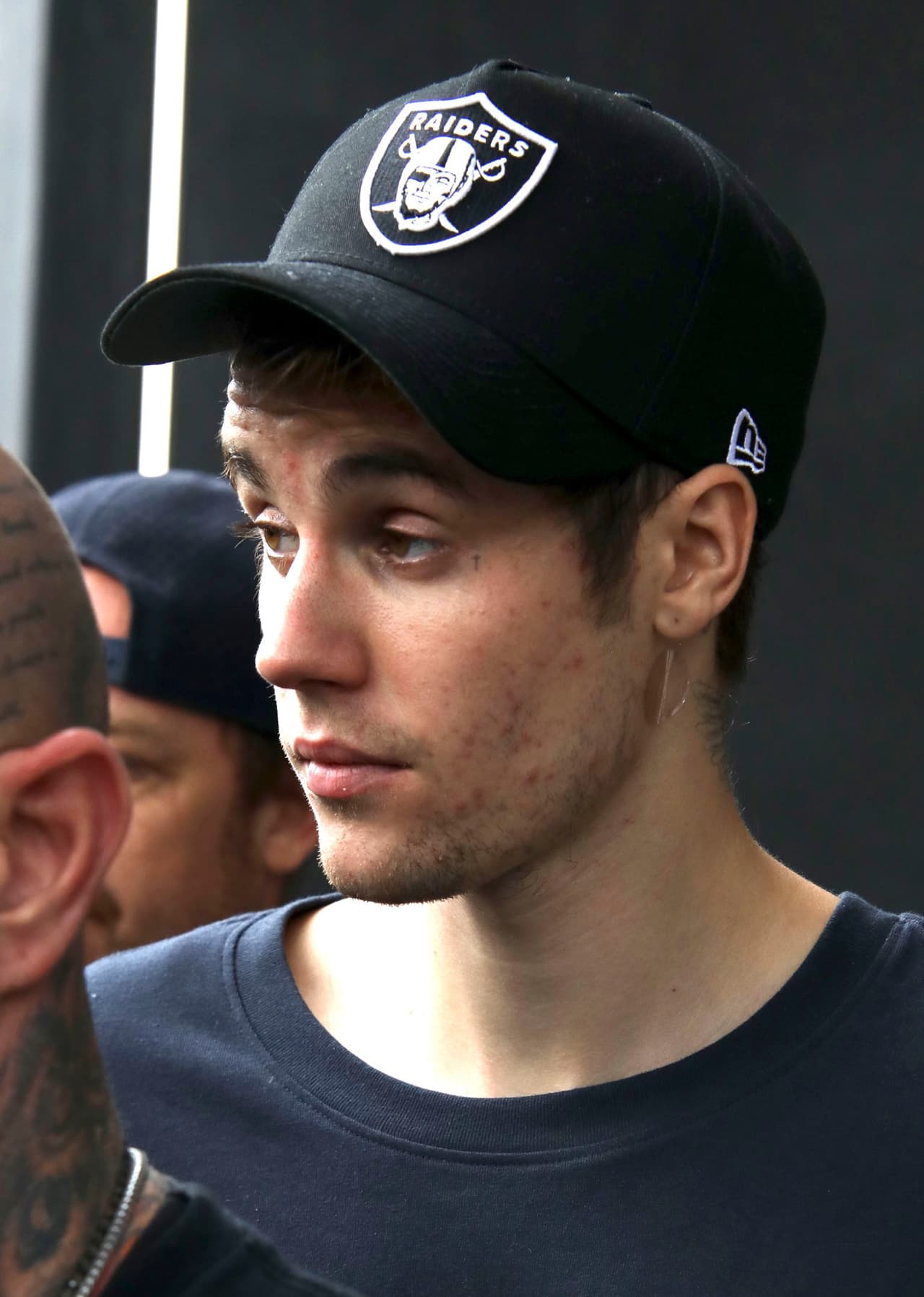 Pero ahora, las cámaras de la agencia The Grosby Group lo captaron el jueves 25 de julio usando un par de
<b> parches medicinales </b>bajo cada una de sus orejas.