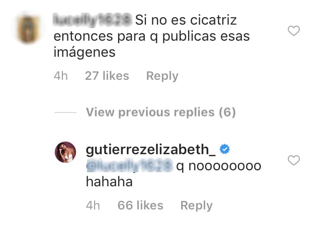 Pero al parecer todos quedaron muy confundidos ante la publicación, pues no entendieron para qué se mostró en un ángulo donde parecía tener marcada la piel.