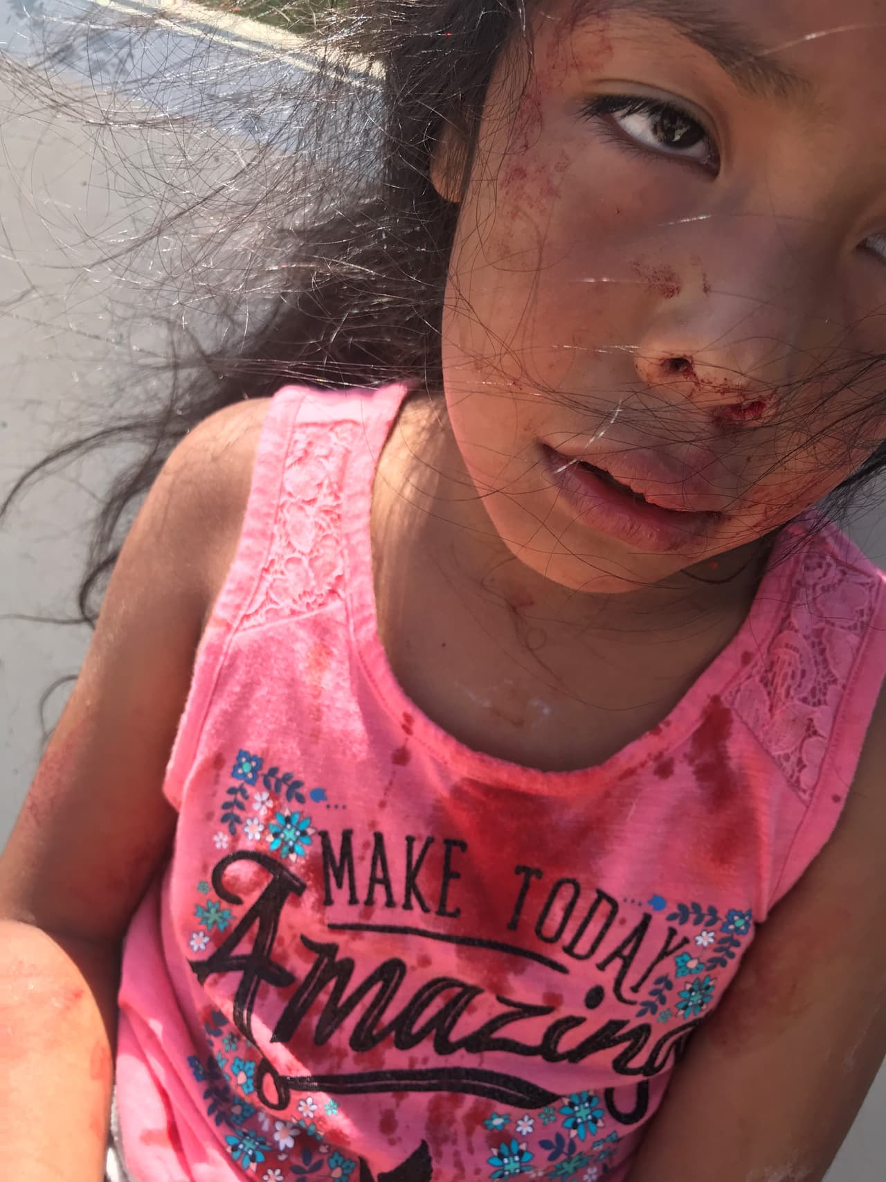 El ataque dejó a la niña desconcertada y con una herida en la parte hisquierda de su cabeza que resultó en fractura de cráneo.