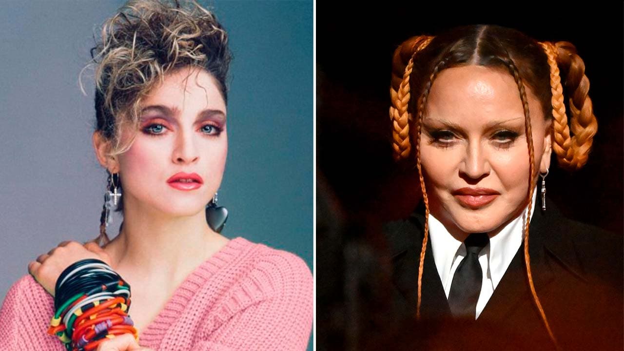 Critican la "obsesión" de Madonna con las cirugías, pero ella respondió lo que pasa en realidad