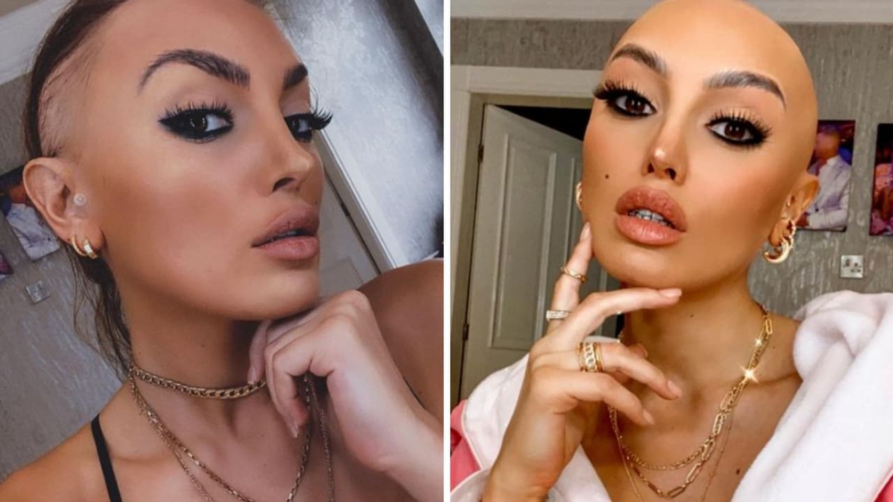 Conoce a la modelo con alopecia que conquista el mundo de la moda: ZaraLena Jackson