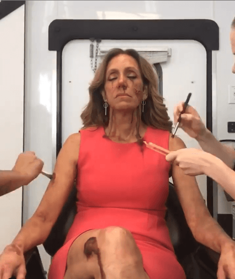 “Me ha dado un golpe en la cabeza que me tumbó al piso y sangré por todos lados. Me rompí la quijada, la nariz y todo el mundo me vio tirada en el piso. Bill me vio y empezó a gritar ‘Dios mío, eso es sangre real’, yo solo me reí”, relató La Flaca.