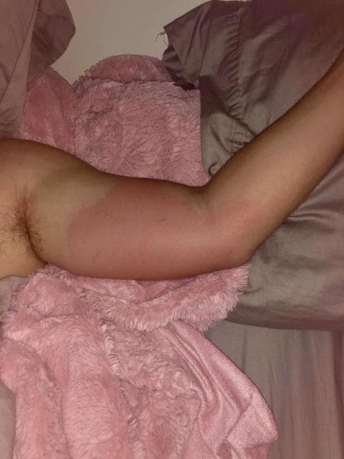 "No tenía ninguna herida abierta, ni nadé en ningún agua ese día. Es 100% desconocido acerca de por qué o cómo me infecté, pero de todos modos fui infectado", comentó King quien estuvo en la localidad de Santa Rosa.