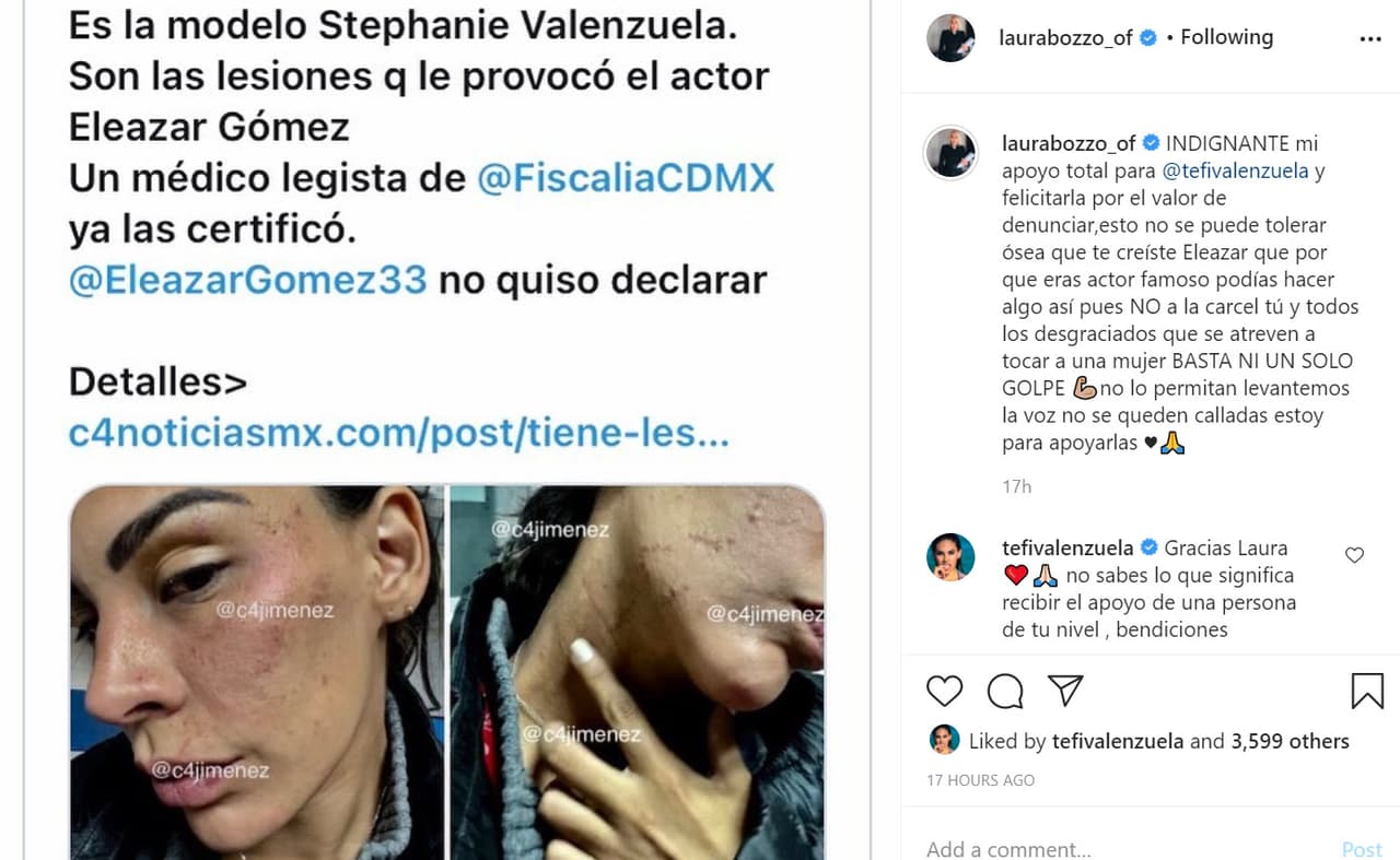 "Indignante, mi apoyo total para 'Tefi' Valenzuela y felicitarla por el valor de denunciar. Esto no se puede tolerar, ó sea, 
<b><a href="https://www.instagram.com/p/CHbMvzRBJ1_/" target="_blank">qué te creíste Eleazar</a></b>: que por que eras actor famoso podías hacer algo así, pues no", escribió en un mensaje junto con las fotos que han circulado de la modelo peruana en las que aparece con las lesiones y mordidas en el rostro que supuestamente le hizo el artista. 
<br>