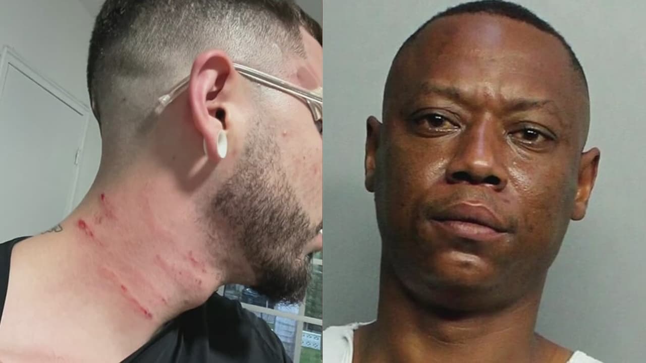 Joven de Miami denuncia ser víctima de un crimen de odio: acusa a su vecino de agredirlo por ser homosexual