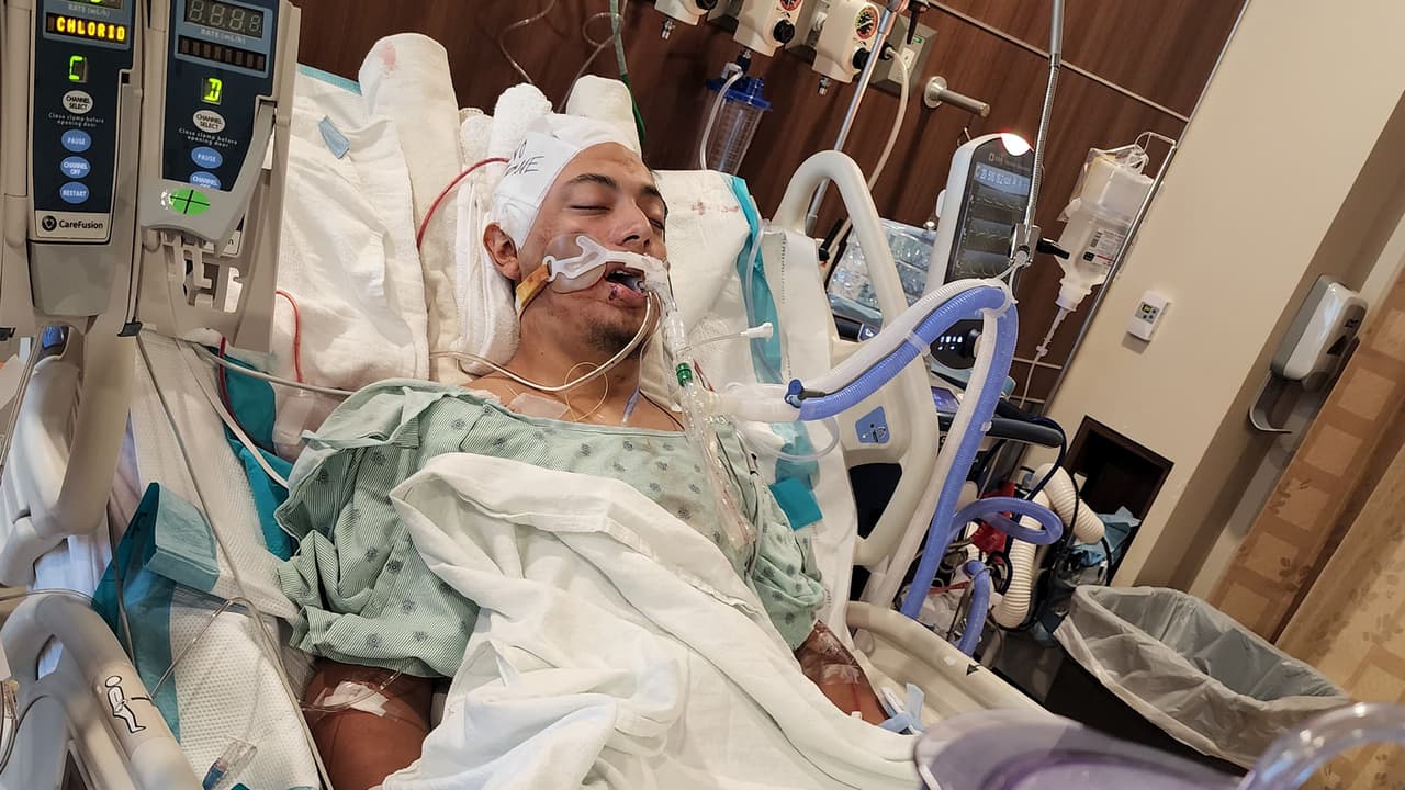 El joven hispano, originario de Monterrey, Nuevo León, fue trasladado a un hospital local en donde actualmente lucha por su vida.